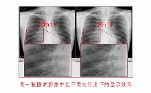 医用灰阶显示器多少钱